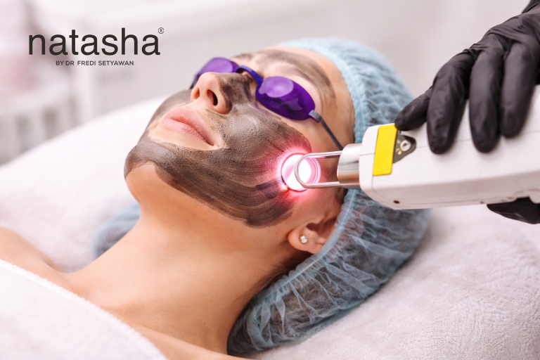 Laser untuk Mencerahkan Wajah_ Cara Kerja, Manfaat, dan Apakah Aman_